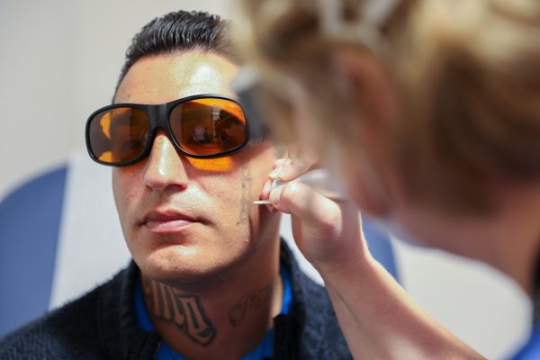New Tattoo Removal Program helps Inland Empire patients reset, aims to curb violence